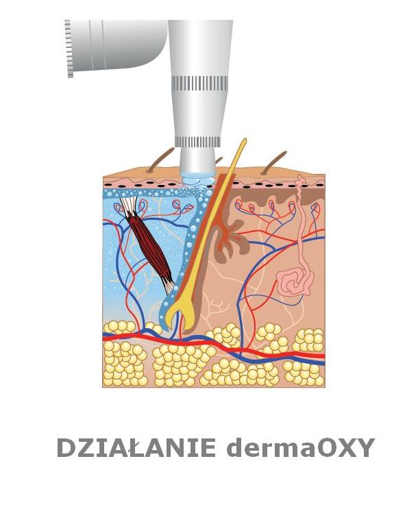 INFUZJA TLENOWA DERMAOXY